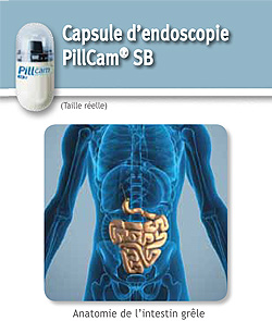 vce-pillcam-patient