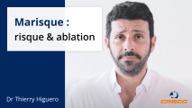 Marisque : définition, opération et les suites de l’opération